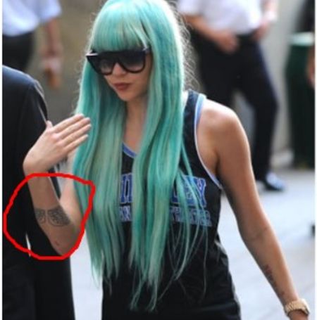  Amanda Bynes went through the tattoo removal process where she erased her angel wing tattoo.